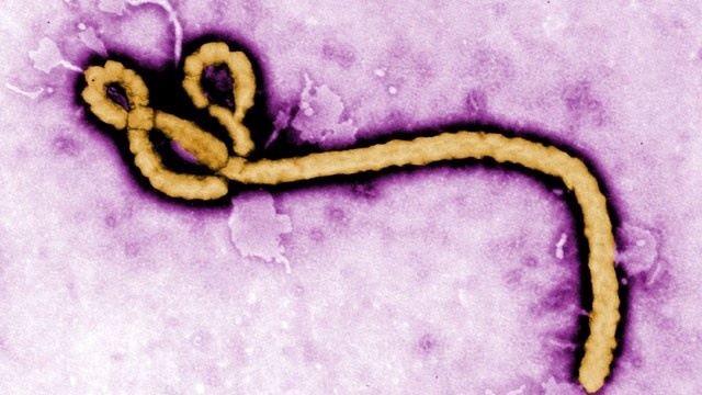 超击病毒来袭 澳洲机场设防阻击埃博拉‏